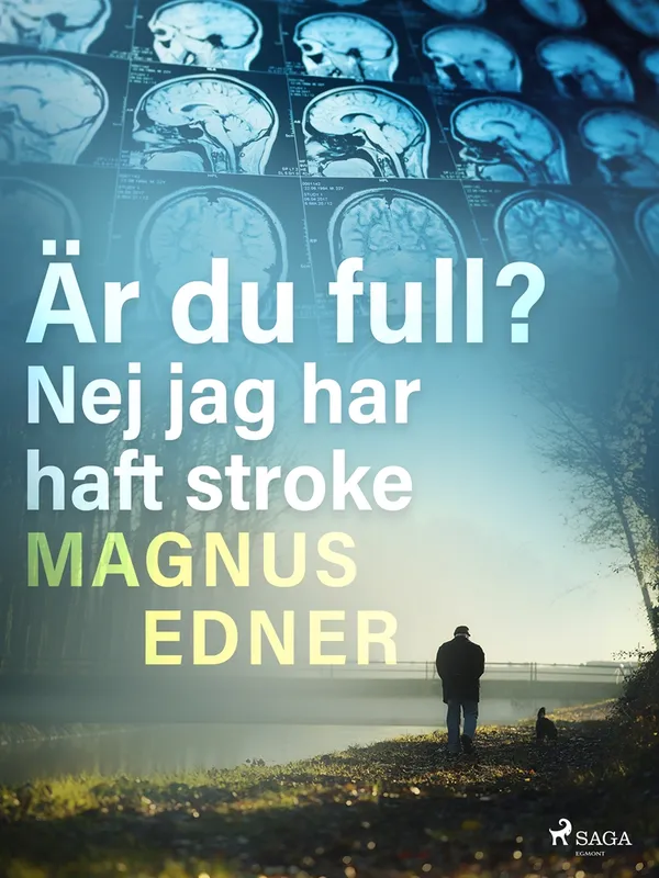 Är du full? Nej jag har haft stroke, E-bok